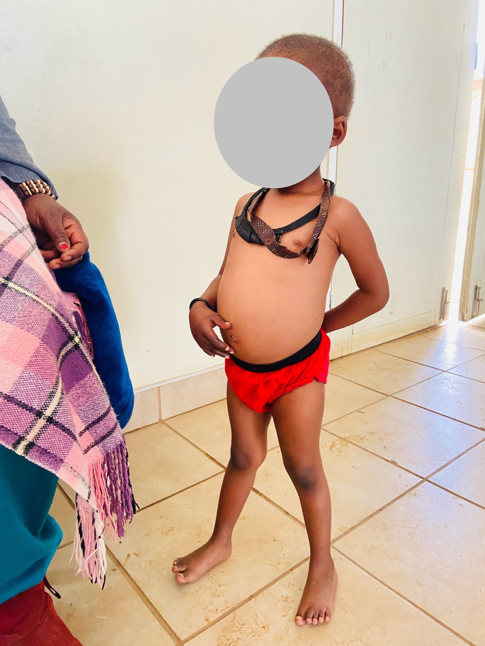 BOTHA-BOTHE FORMS NUTRITION PLATFORM TO TACKLE MALNUTRITION 