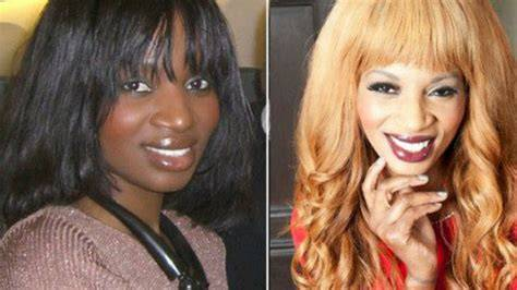 PHARMACIST WARNS OF ESCALATING RISKS OF SKIN LIGHTENING CREAMS 